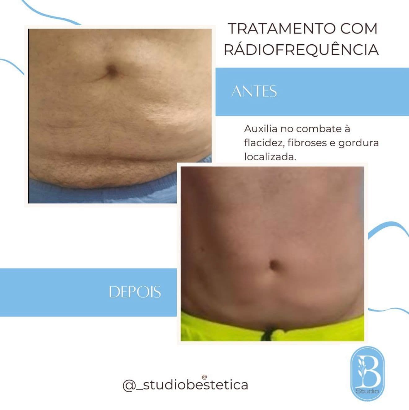Progresso 1