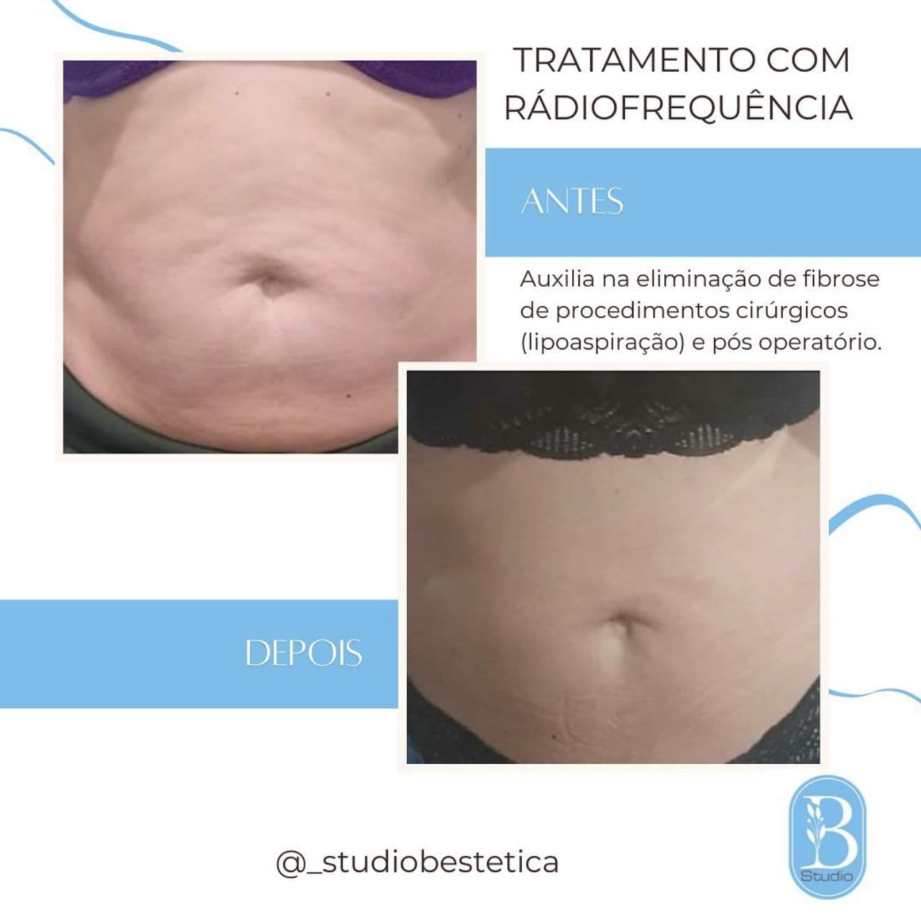 Progresso 2
